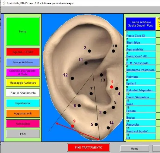 Software per il trattamento antifumo con l'Auricoloterapia.