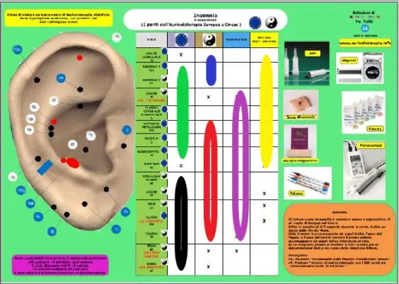 L'insonnia trattata con l'Auricoloterapia.
