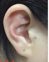 Auricoloterapia con micro magneti. Auricoloterapia con micro magneti. Dott. P. Ventura.